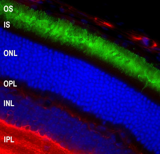 Rhodopsin Antibody in Immunohistochemistry (IHC)