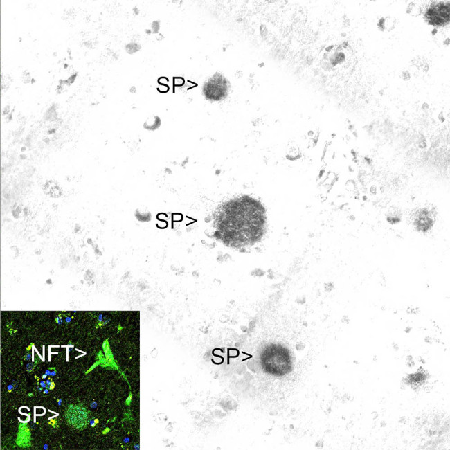 beta Amyloid Antibody in Immunohistochemistry (IHC)