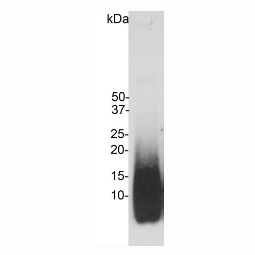 beta Amyloid Antibody in Western Blot (WB)