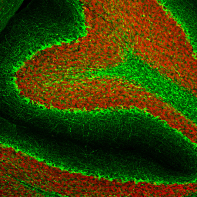 NF-H Antibody in Immunohistochemistry (PFA fixed) (IHC (PFA))