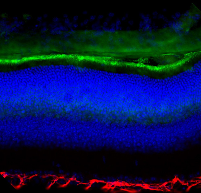 S-arrestin Antibody in Immunohistochemistry (IHC)