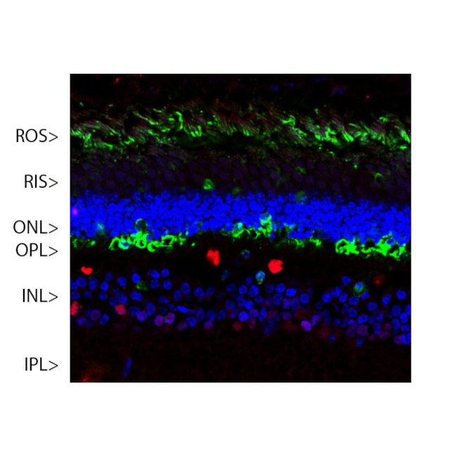 S-arrestin Antibody in Immunohistochemistry (IHC)