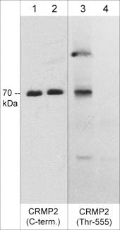 Phospho-CRMP2 (Thr555) Antibody in Western Blot (WB)