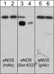 Phospho-eNOS (Ser632) Antibody in Western Blot (WB)