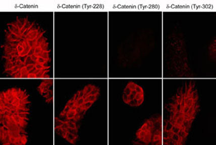 Phospho-delta Catenin (Tyr228) Antibody in Immunocytochemistry (ICC/IF)