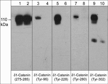 Phospho-delta Catenin (Tyr228) Antibody in Western Blot (WB)