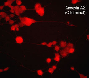 Annexin A2 Antibody in Immunocytochemistry (ICC/IF)