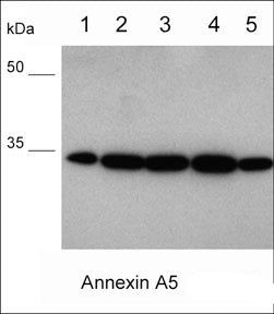 Annexin V Antibody in Western Blot (WB)