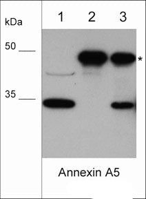 Annexin V Antibody in Western Blot (WB)