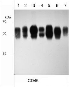 CD46 Antibody in Western Blot (WB)