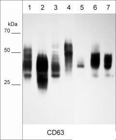 CD63 Antibody in Western Blot (WB)