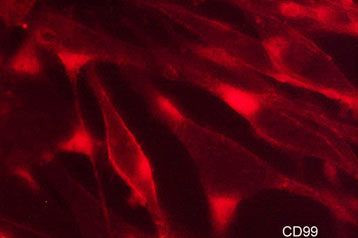 CD99 Antibody in Immunocytochemistry (ICC/IF)