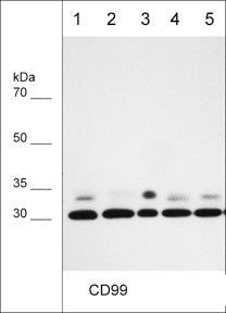 CD99 Antibody in Western Blot (WB)