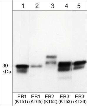 EB1 Antibody in Western Blot (WB)