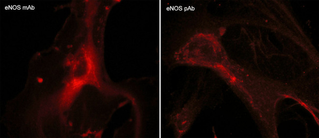 eNOS Antibody in Immunocytochemistry (ICC/IF)