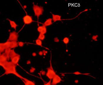 PKC delta Antibody in Immunocytochemistry (ICC/IF)