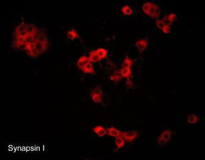 Synapsin 1 Antibody in Immunocytochemistry (ICC/IF)