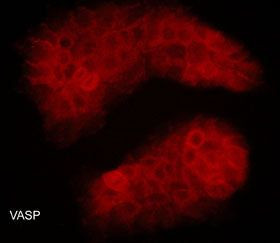 VASP Antibody in Immunocytochemistry (ICC/IF)