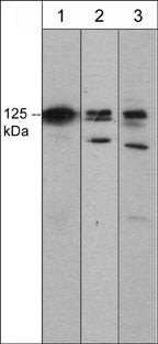 DAAM1 Antibody in Western Blot (WB)