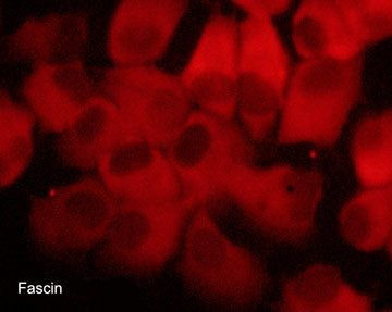 Fascin Antibody in Immunocytochemistry (ICC/IF)