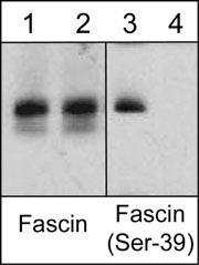 Fascin Antibody in Western Blot (WB)