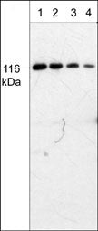 PYK2 Antibody in Western Blot (WB)