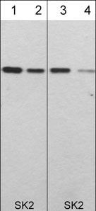 SPHK2 Antibody in Western Blot (WB)