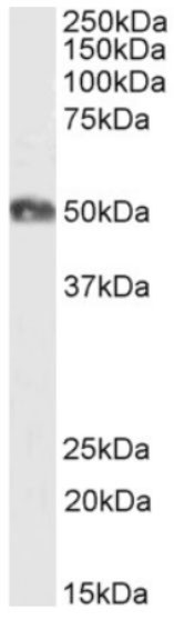 CD2 Chimeric Antibody in Western Blot (WB)