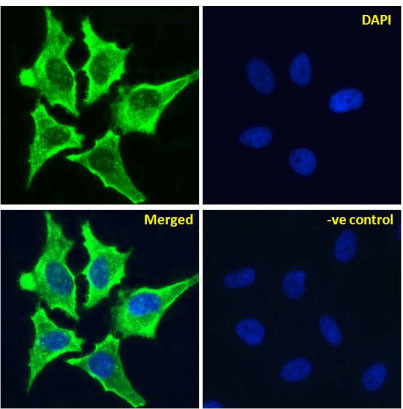 AOC3 Chimeric Antibody in Immunocytochemistry (ICC/IF)