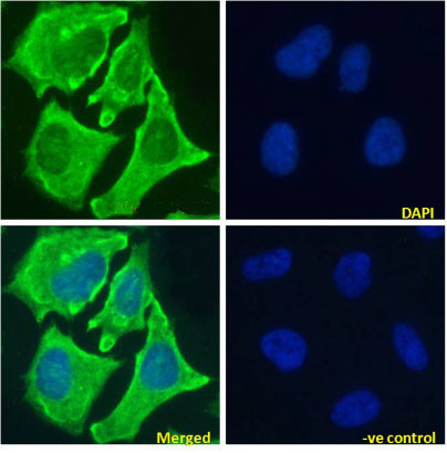 NOTCH1 Chimeric Antibody in Immunocytochemistry (ICC/IF)