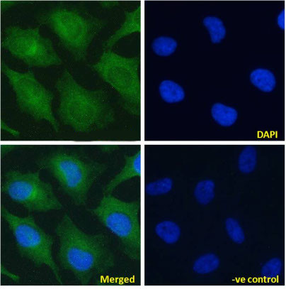 NOTCH2 Chimeric Antibody in Immunocytochemistry (ICC/IF)