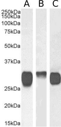 HLA-DR/DP/DQ Chimeric Antibody in Western Blot (WB)