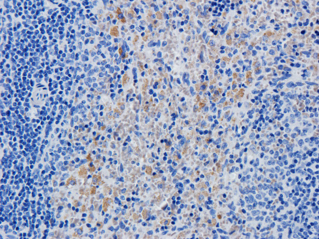 Daclizumab Antibody in Immunohistochemistry (PFA fixed) (IHC (PFA))