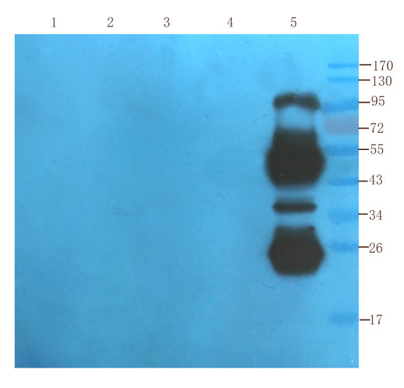 Daclizumab Antibody in Western Blot (WB)