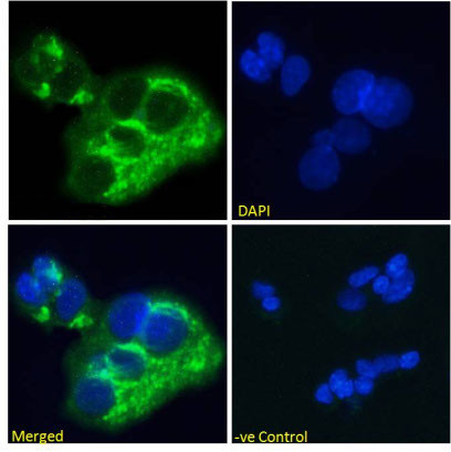 AFP Chimeric Antibody in Immunocytochemistry (ICC/IF)