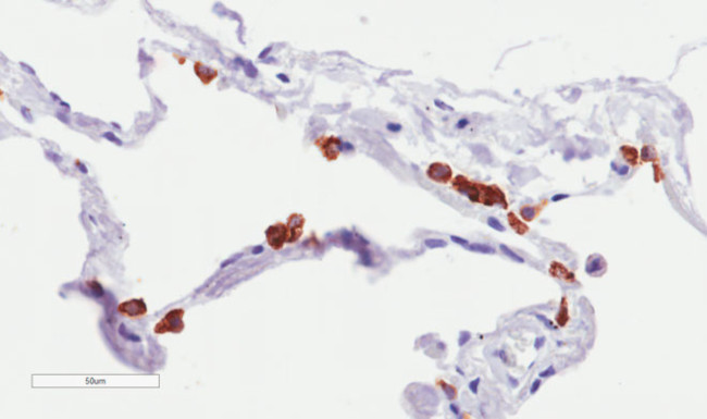 MUC1 Chimeric Antibody in Immunohistochemistry (Paraffin) (IHC (P))