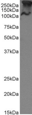 MUC1 Chimeric Antibody in Western Blot (WB)