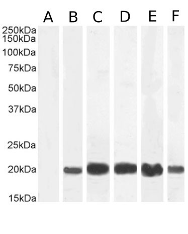 IL-2 Chimeric Antibody in Western Blot (WB)
