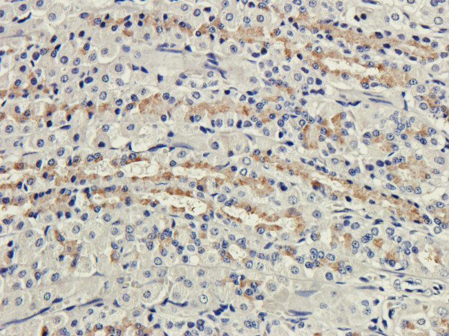 CD35 Chimeric Antibody in Immunohistochemistry (PFA fixed) (IHC (PFA))