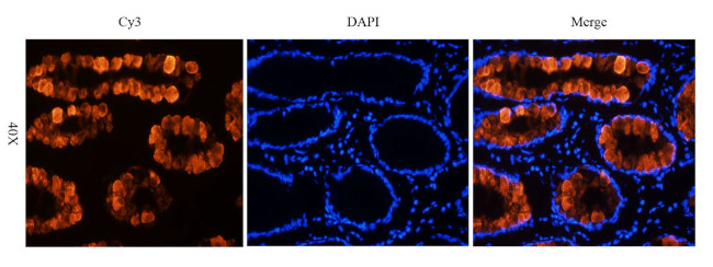 Satumomab Antibody in Immunohistochemistry (PFA fixed) (IHC (PFA))