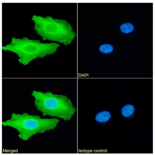 Calreticulin Antibody in Immunocytochemistry (ICC/IF)