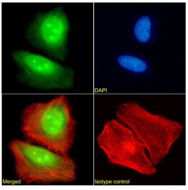 FEN1 Antibody in Immunocytochemistry (ICC/IF)