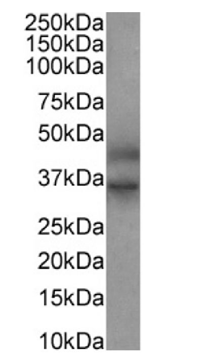 FEN1 Antibody in Western Blot (WB)