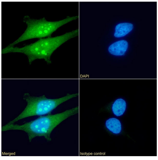 HSP27 Antibody in Immunocytochemistry (ICC/IF)