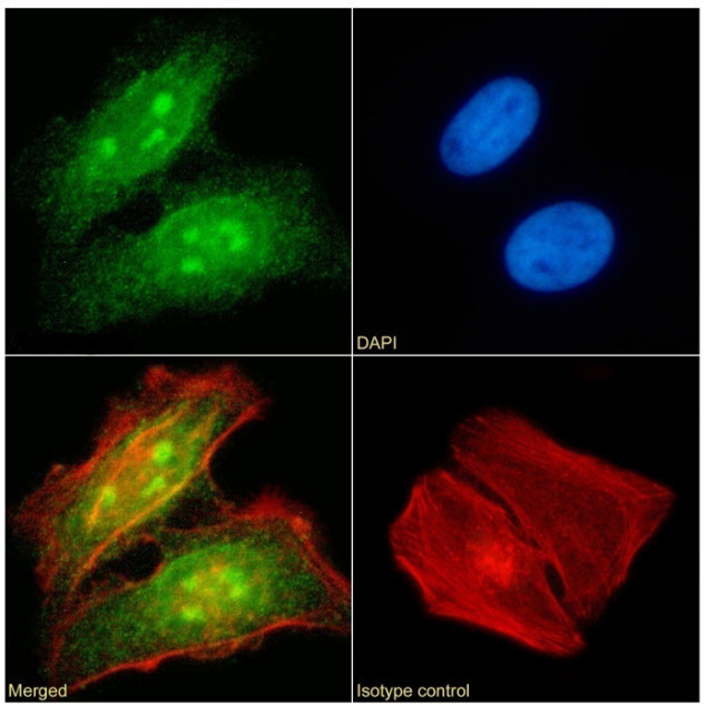 RAD23B Antibody in Immunocytochemistry (ICC/IF)