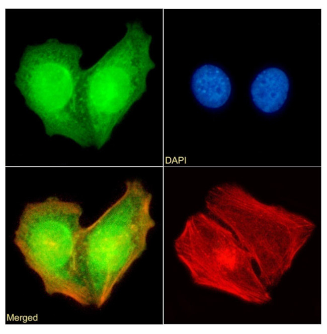 RAD23B Antibody in Immunocytochemistry (ICC/IF)