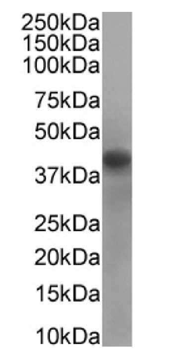 RRM2 Antibody in Western Blot (WB)