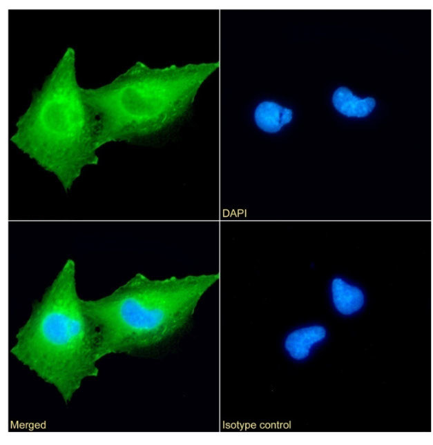 gamma Synuclein Antibody in Immunocytochemistry (ICC/IF)