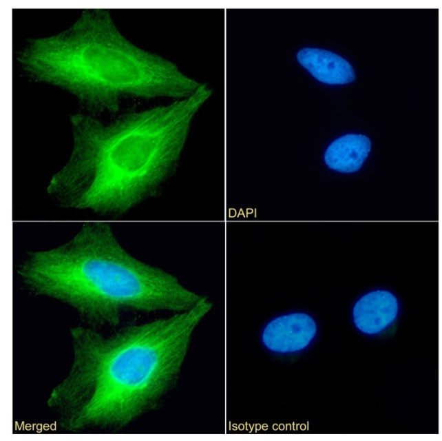 Fascin Antibody in Immunocytochemistry (ICC/IF)