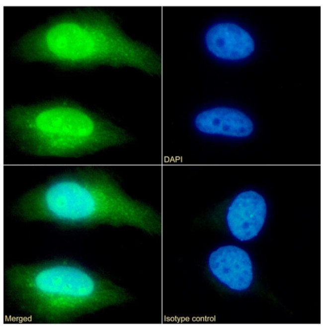 TAGLN Antibody in Immunocytochemistry (ICC/IF)